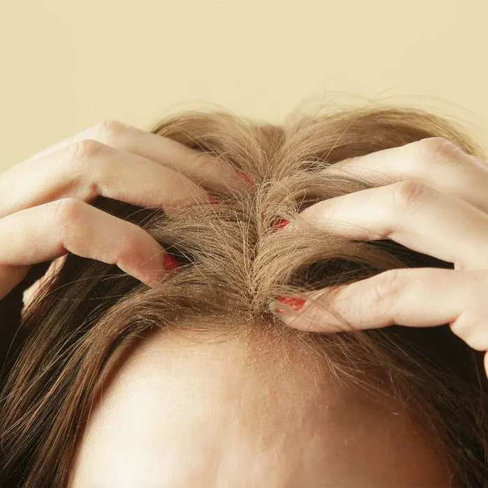 woman-rubbing-her-scalp