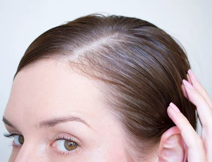 woman-thin-fine-hair