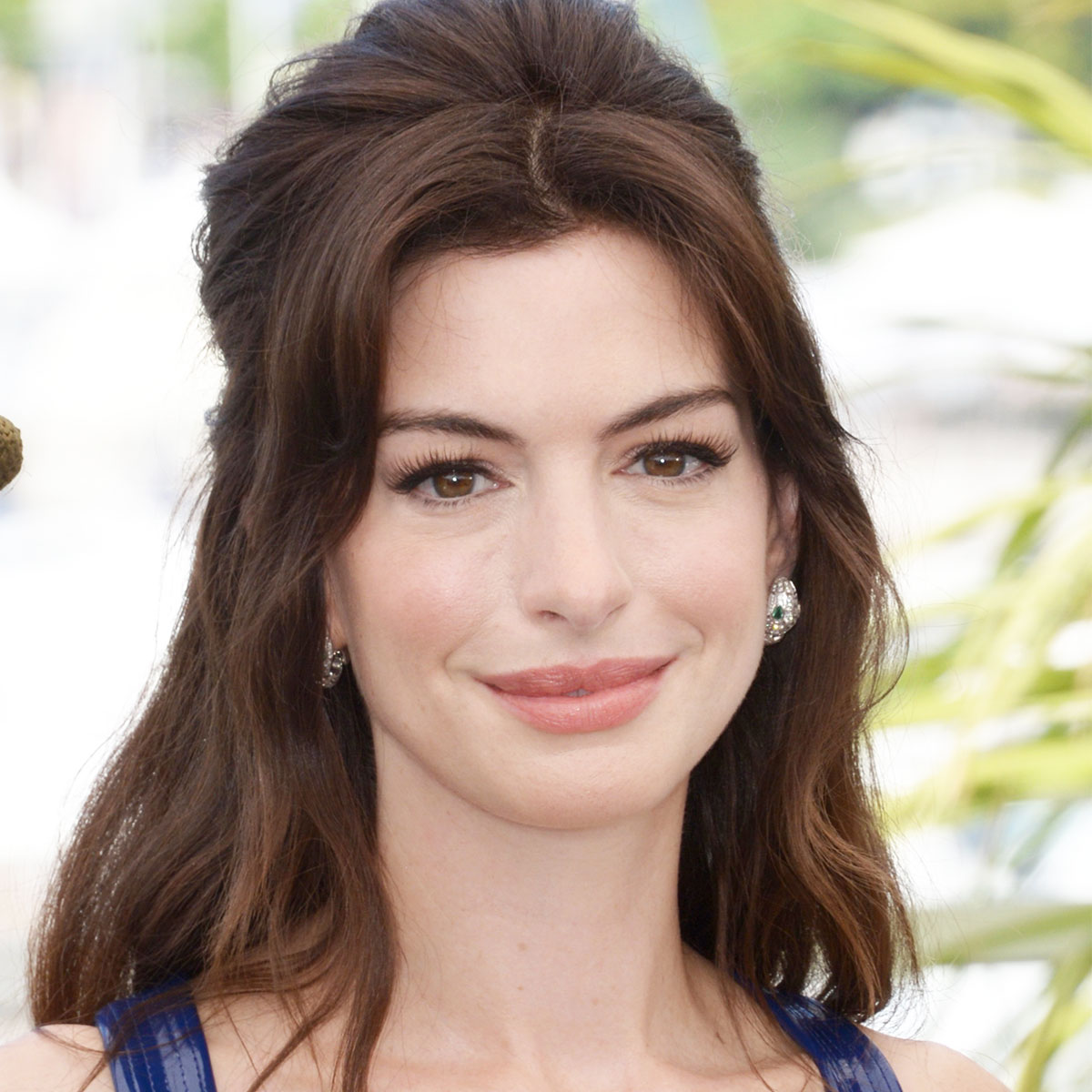 Anne Hathaway Plastic Surgery: Unveiling the Transformation