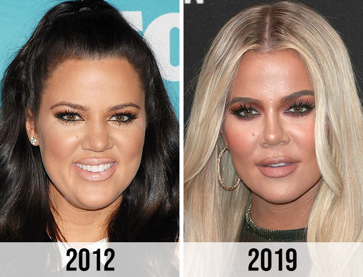 Khloe Kardashian before and after nose 2012 vs 2019