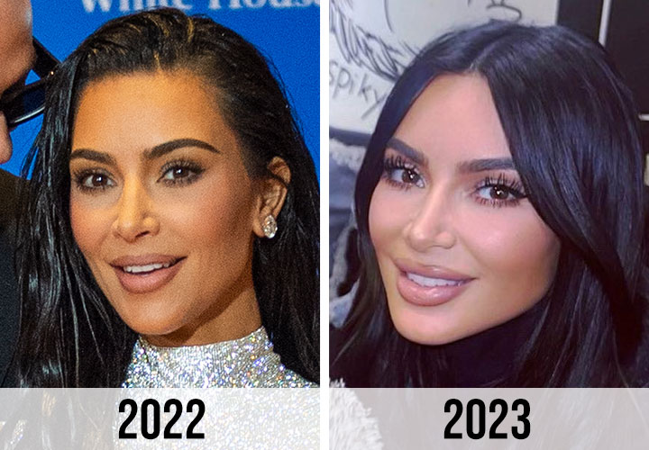 Kim Kardashian before and after lips