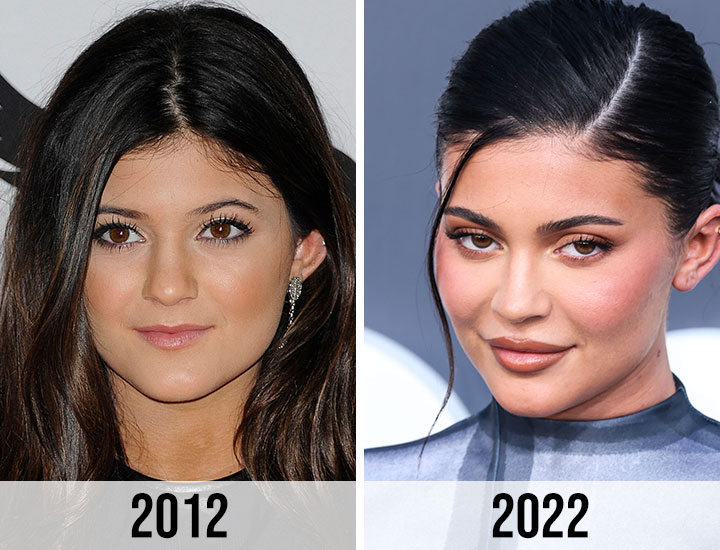 Kylie Jenner before and after 2012 to 2022