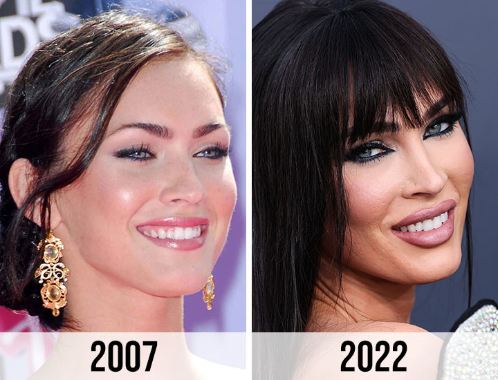 Megan Fox nose 2007 vs 2022