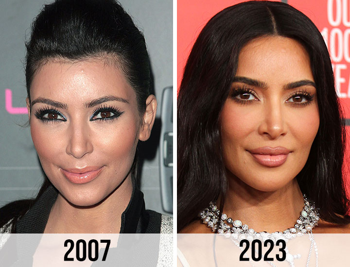 Kim Kardashian lips before and after