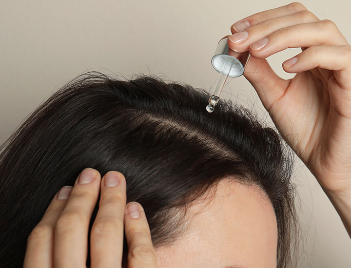 4 Hair Oil Serums To Soothe Flaky, Dry Scalps For Thinning Hair SHEfinds