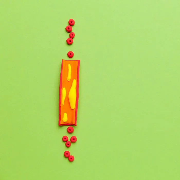 artwork depicting clogged arteries