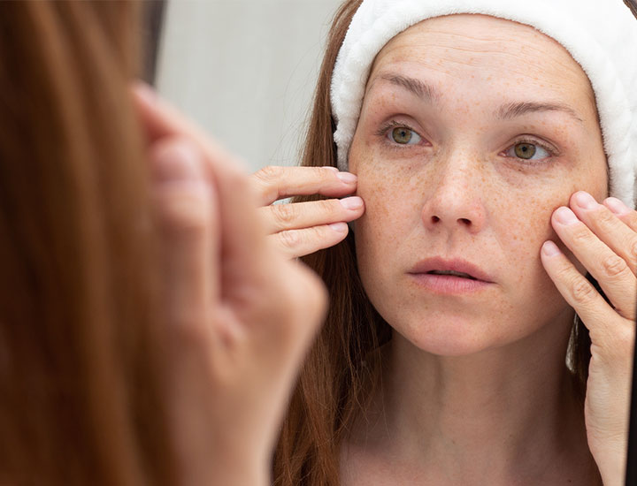woman touching premature wrinkling skin looking in mirror red hear white headband freckles