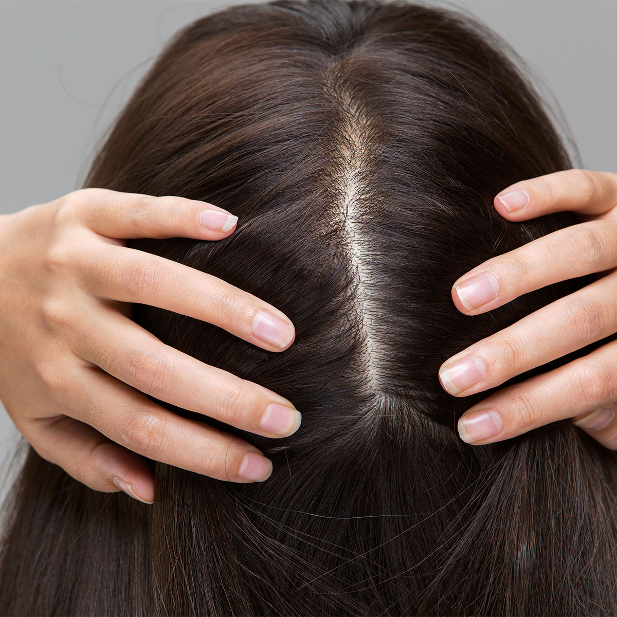 woman showing scalp flat brown hair holding apart with fingers on head