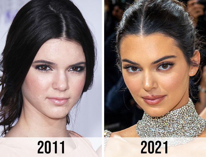 kendall jenner side-by-side older and younger facial differences