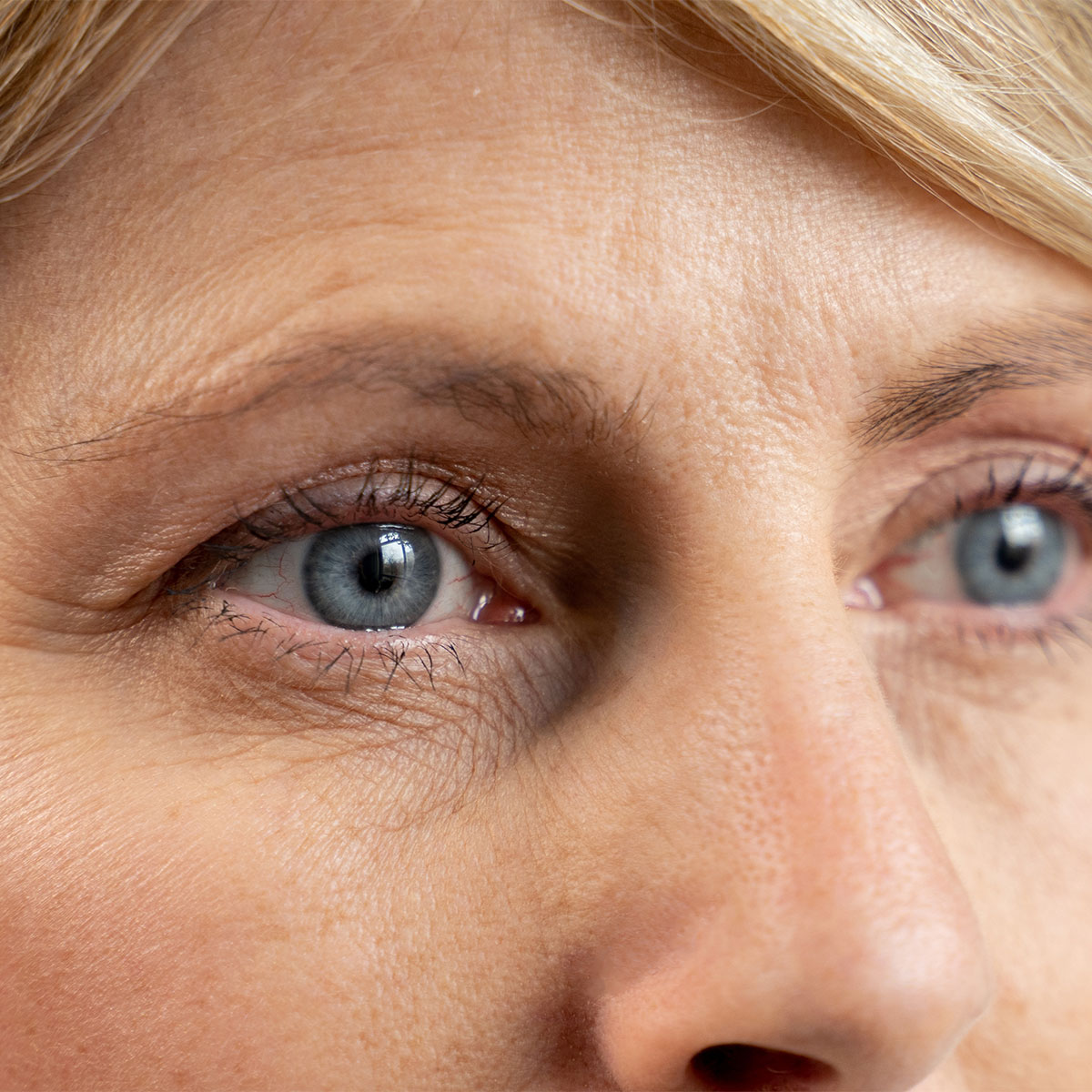 woman close-up blue eyes wrinkles aging skin