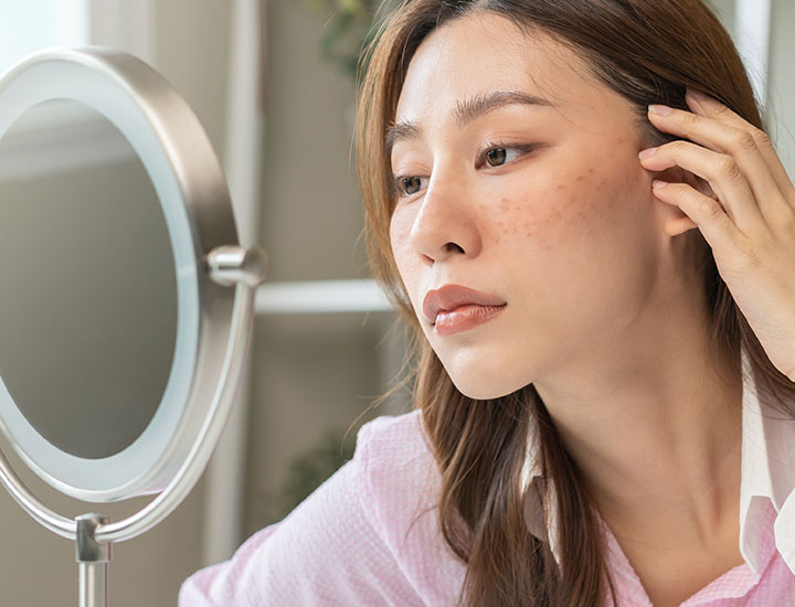 woman-dark-spots-face