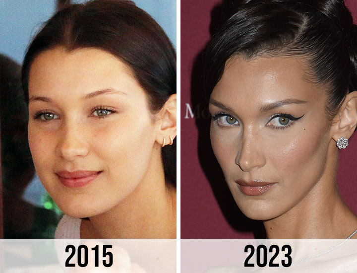 Did Bella Hadid Get Jawline Plastic Surgery? Fans On Instagram Think So -  SHEfinds