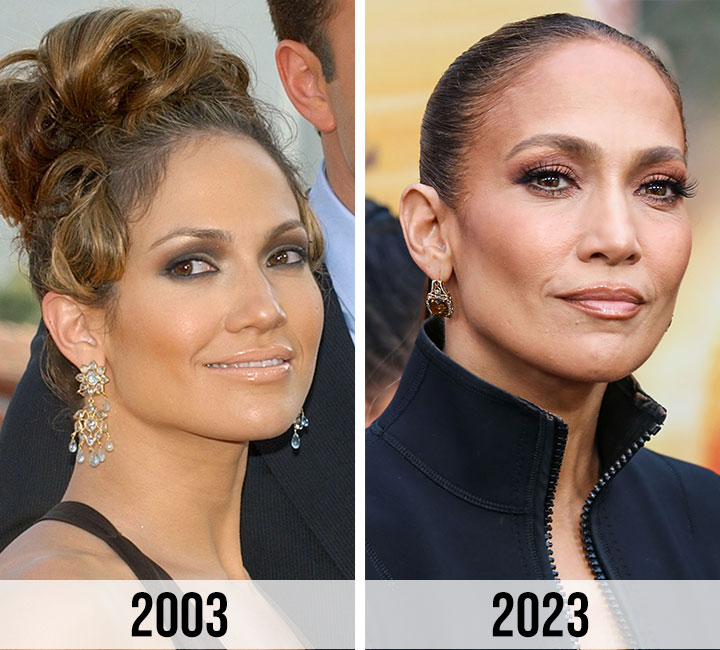 Jennifer Lopez plastic surgery speculation 2003 to 2023