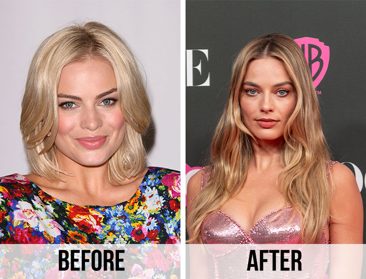 Margot Robbie plastic surgery speculation before and after 2011 2023