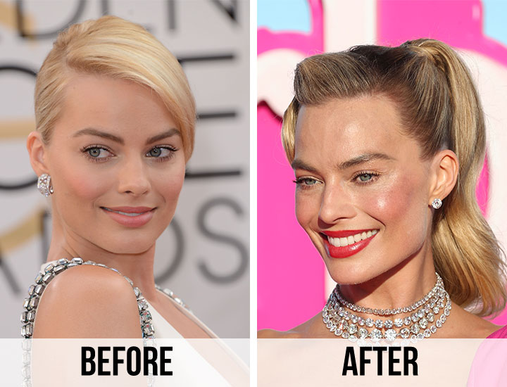 Margot Robbie plastic surgery speculation before and after Barbie 2014 2023
