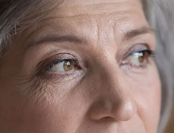 closeup-woman-wrinkles