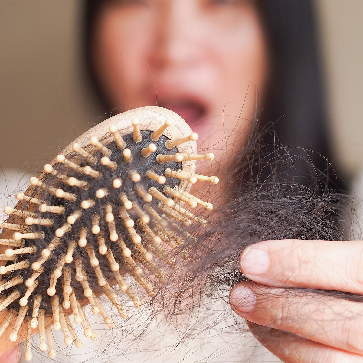 hair loss woman shocked holding up hair brush clumps