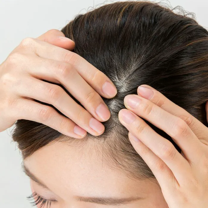 woman touching thinning hair scalp hands