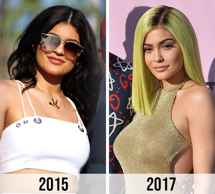 Kylie Jenner revives boob job rumors after putting ample bust on