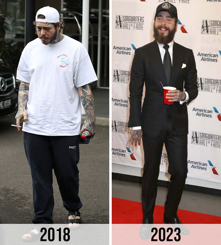 post malone before and after street style red carpet awards suit