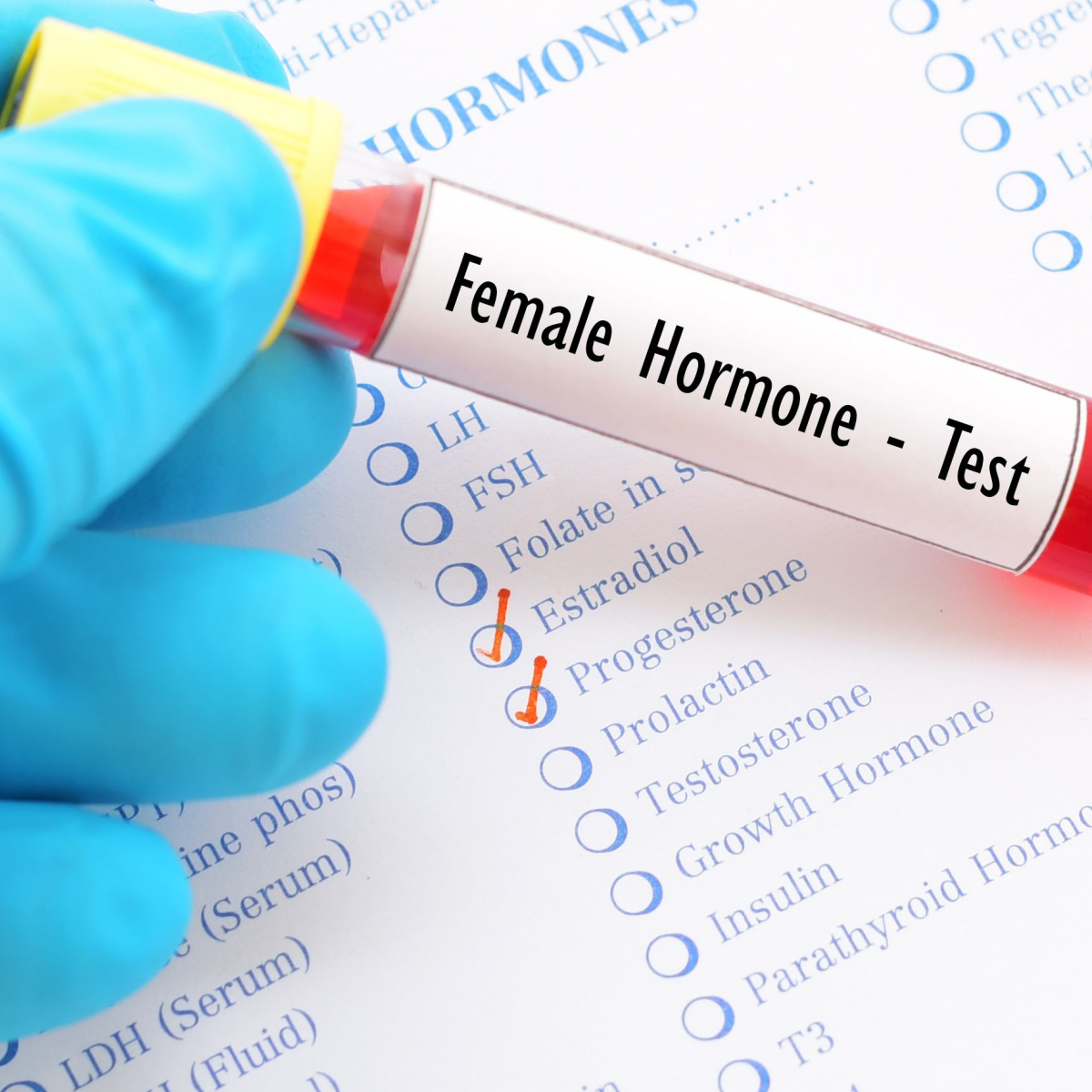 hormone test