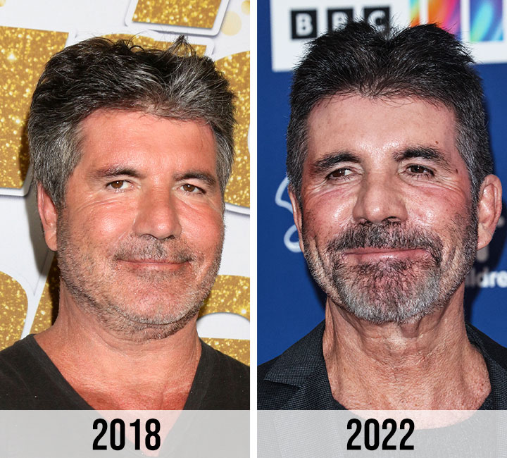 Simon Cowell face transformation 2018 to 2022