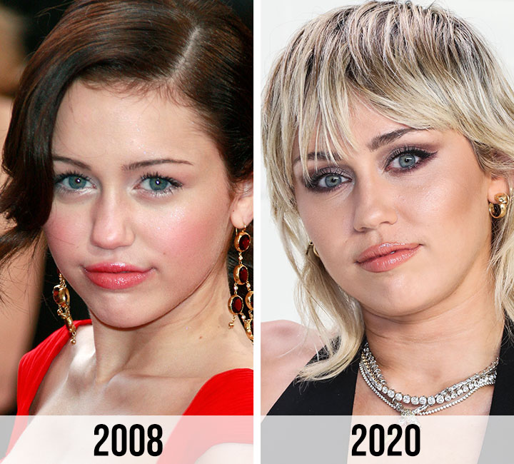 Miley Cyrus lips then and now
