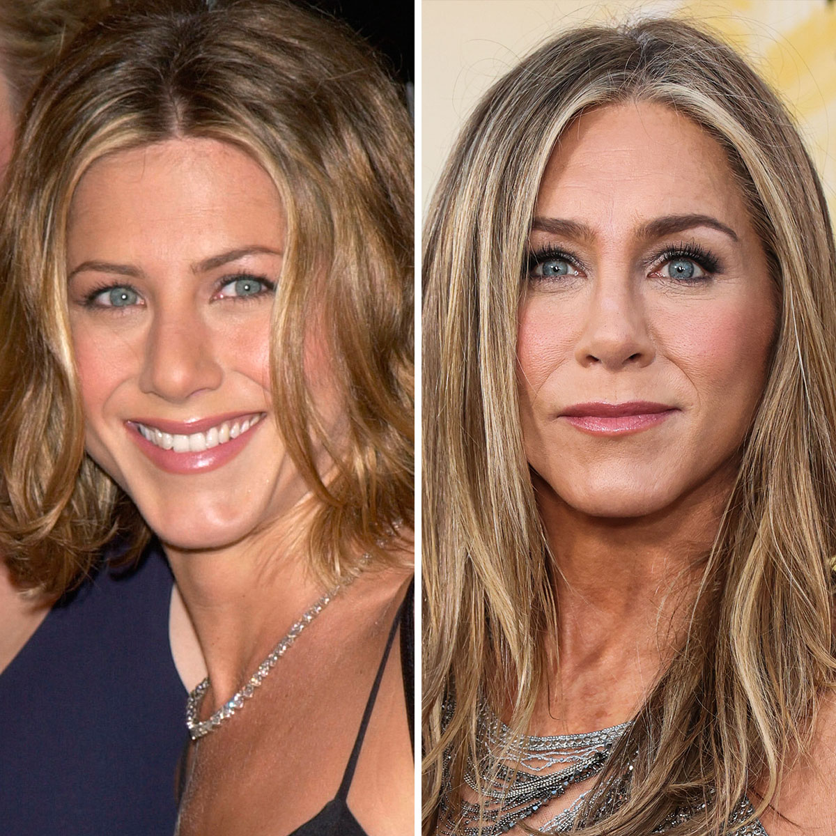 Jennifer Aniston Called 'Unrecognizable and Weird' For Plastic