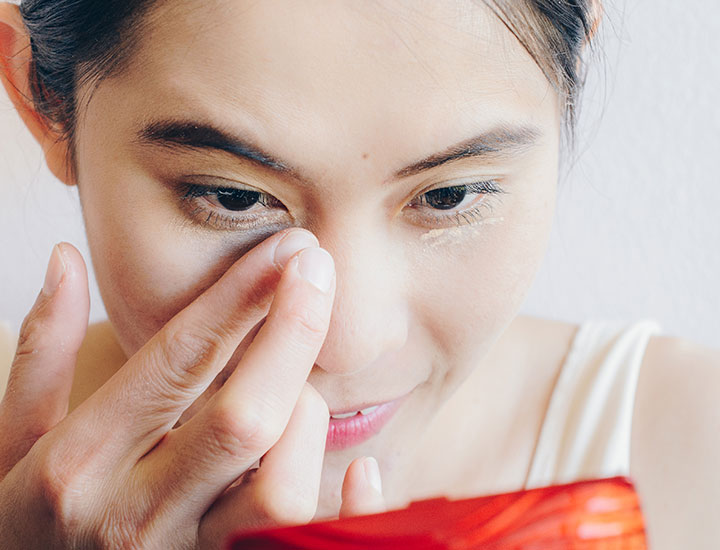 woman-concealing-under-eyes