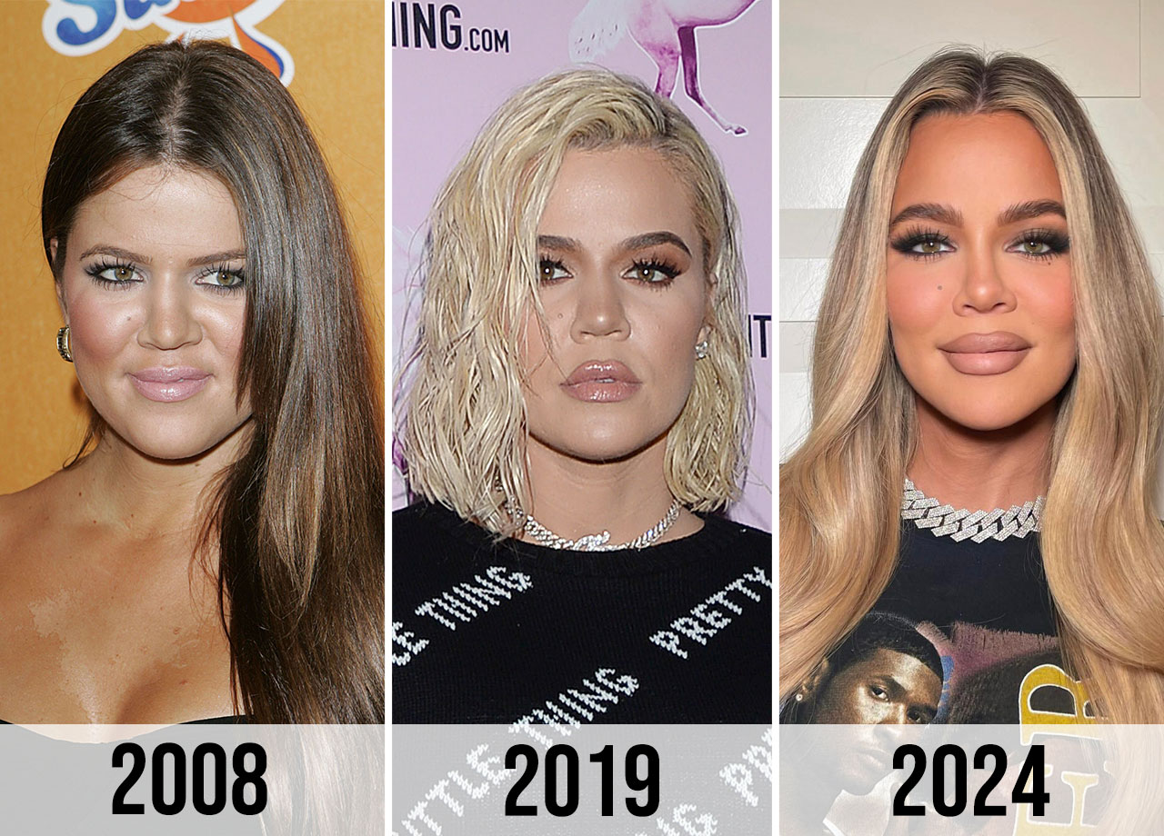 Khloe Kardashian weight loss transformation face changes