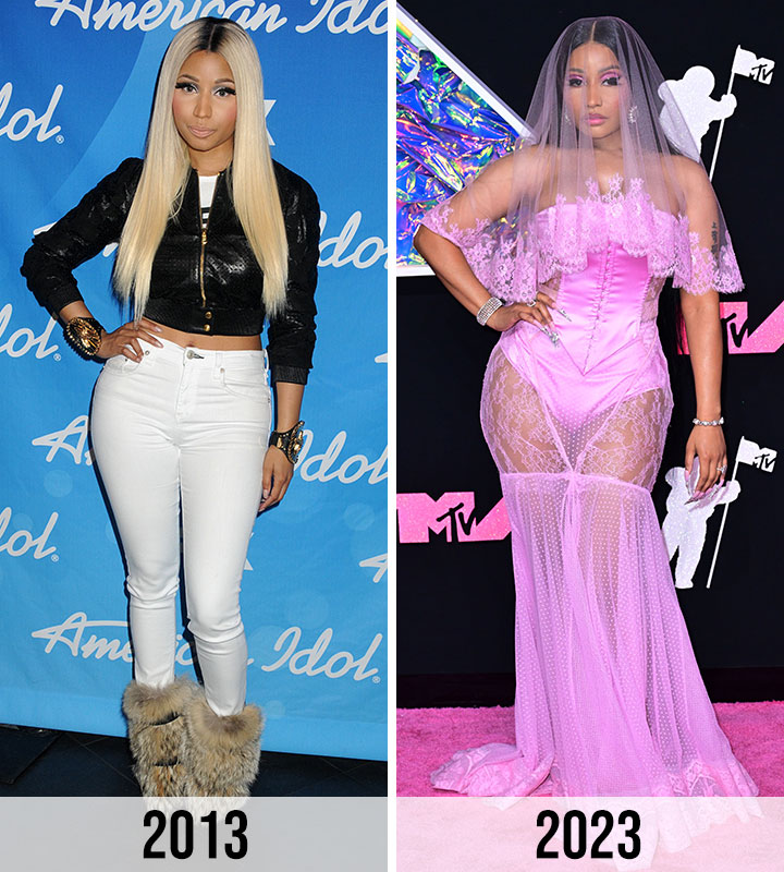 Did Nicki Minaj Get Plastic Surgery? Transformation Photos