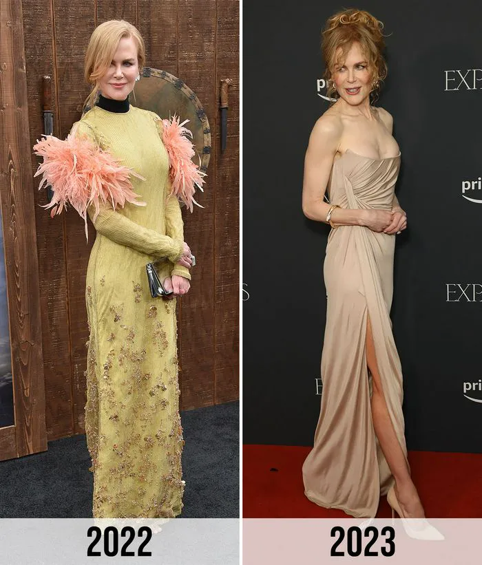 nicole kidman before and after