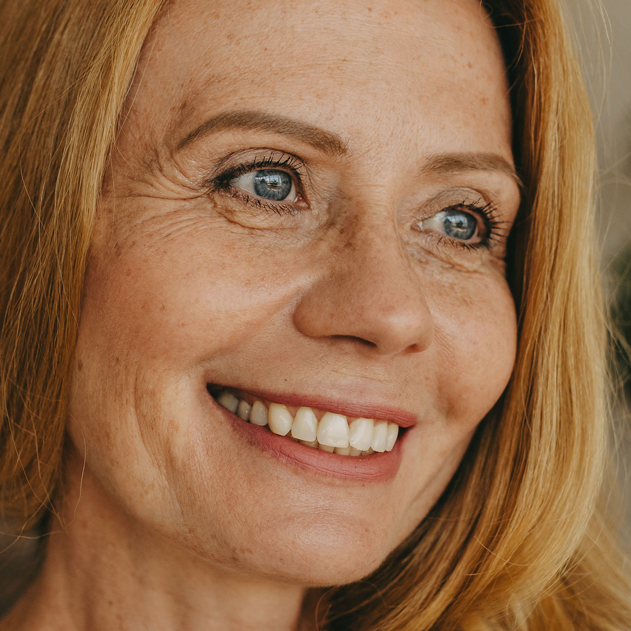 smiling-woman-wrinkles