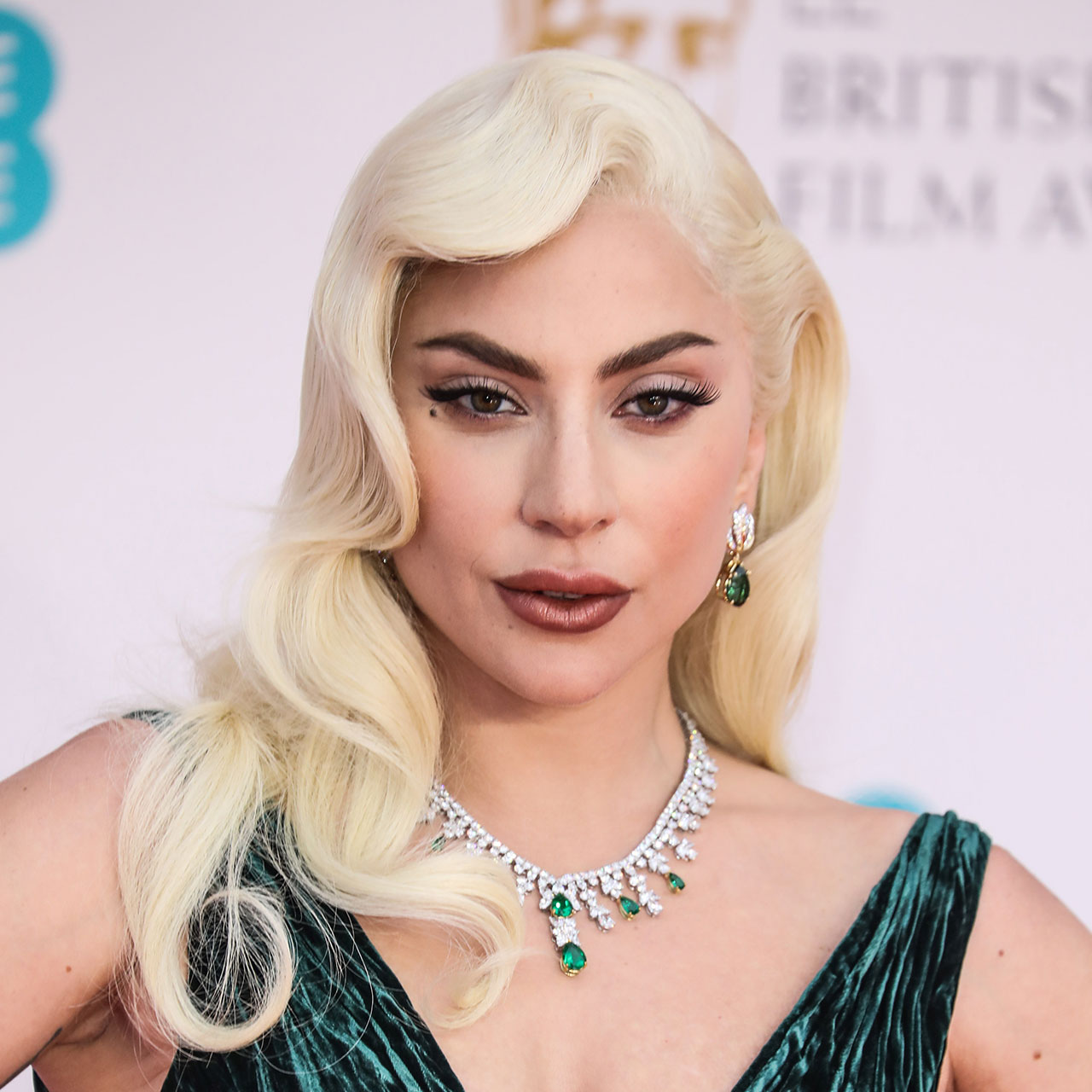 Fans Are Concerned Over Lady Gaga’s ‘Swollen’ Face In New 