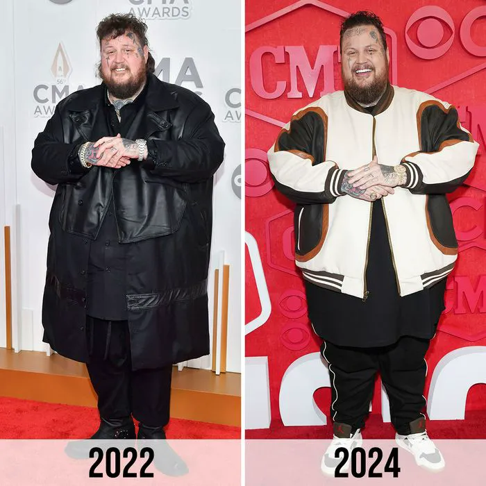 Jelly Roll Shows Off His 70 Lb Weight Loss Transformation After Cha 