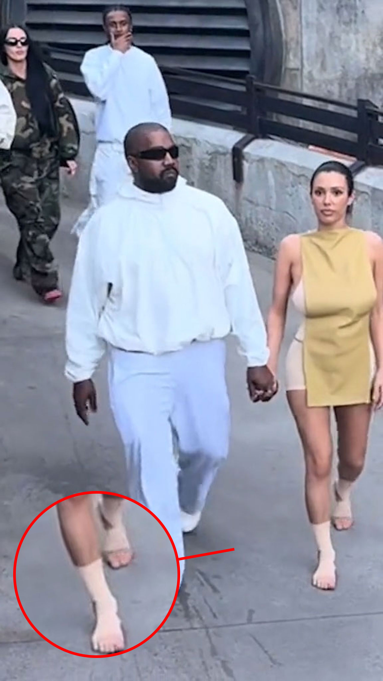 Kanye West and Bianca Censori Disneyland feet ankles bandaged
