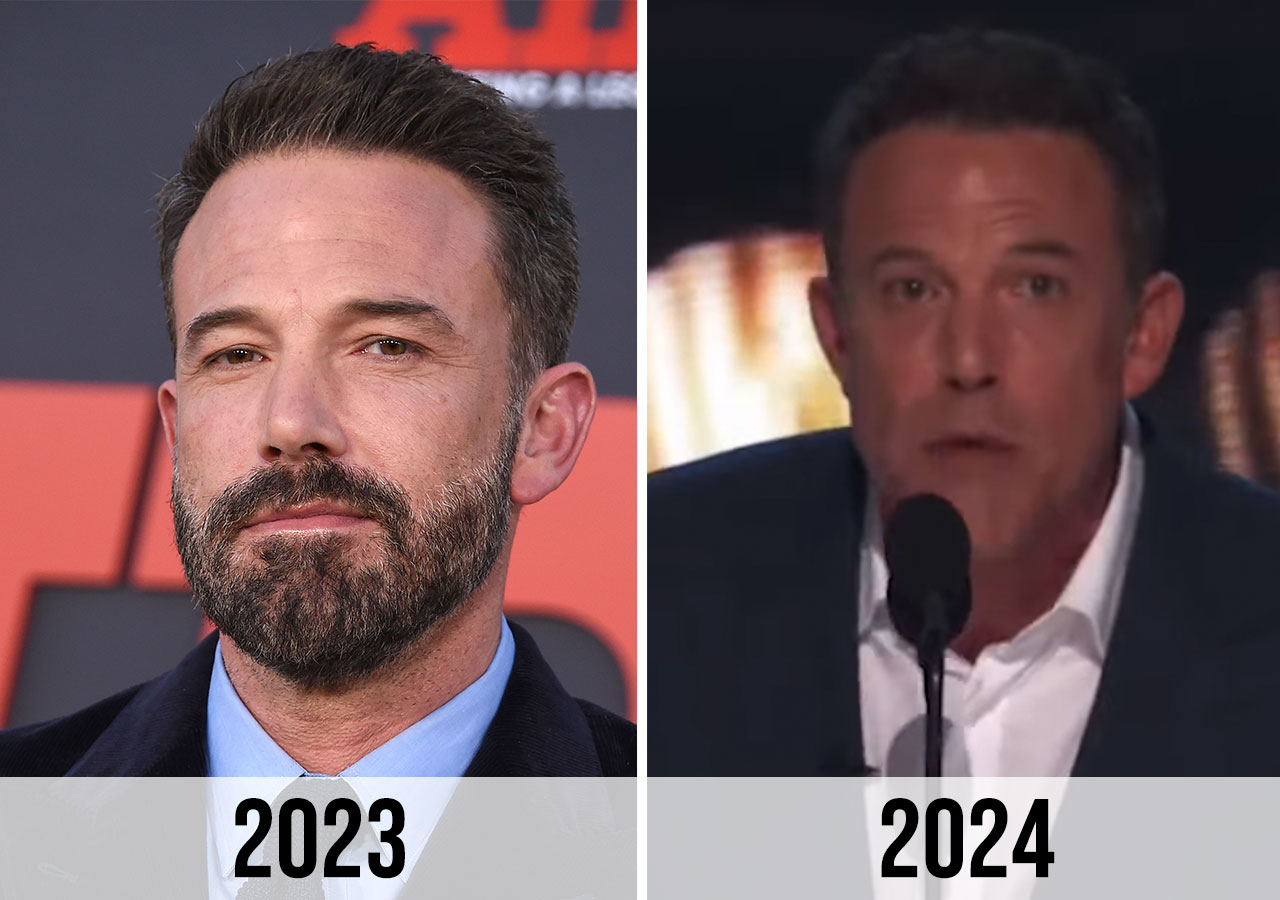 Ben Affleck face before and after 2023 to 2024