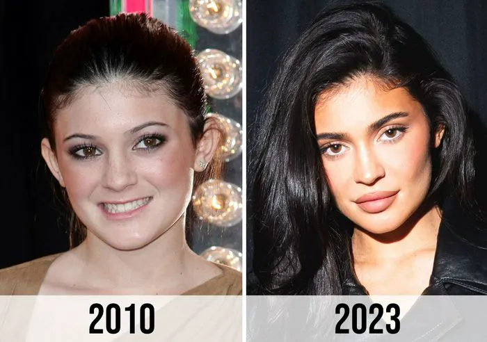 Fans React To Kylie Jenner s Transformation Over The Years After She Fans React To Kylie Jenner s Transformation Over The Years After She