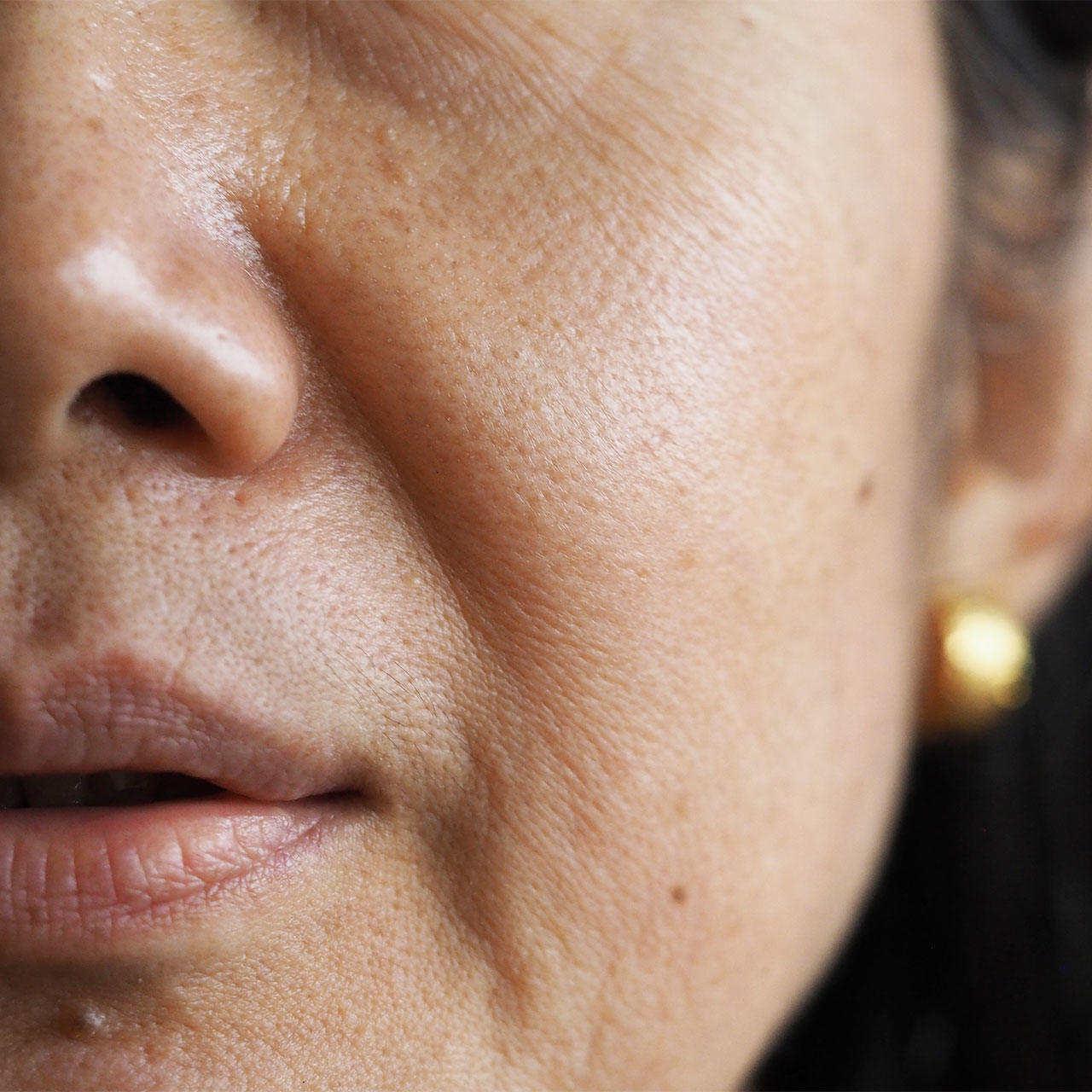 7 SkinDamaging Processed Foods That Can ‘Lead To Wrinkles,’ According