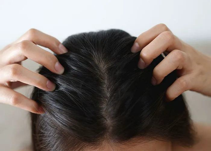 woman-healthy-scalp