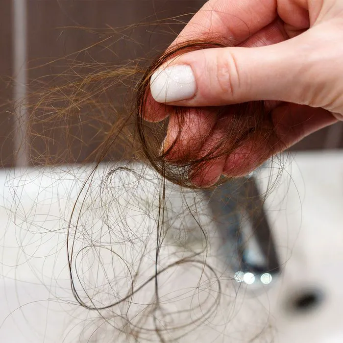 "Woman losing hair in clumps"