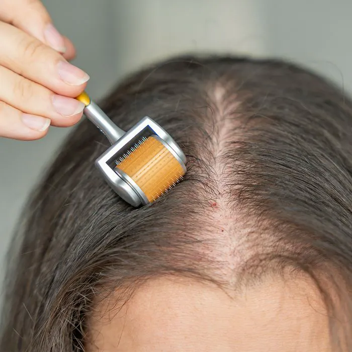"Woman using a derma roller on her scalp with fine, dull hair"