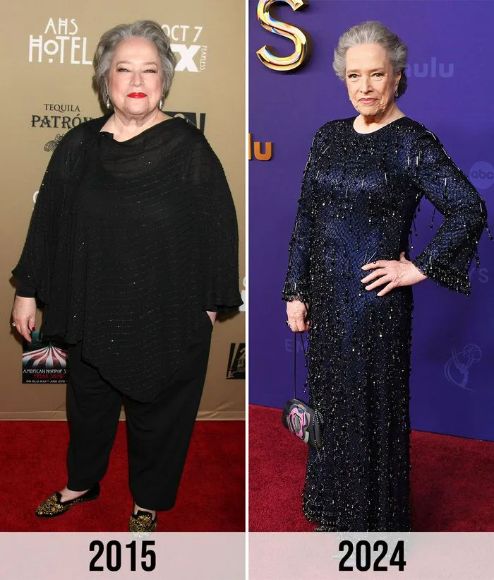 Kathy Bates before and after