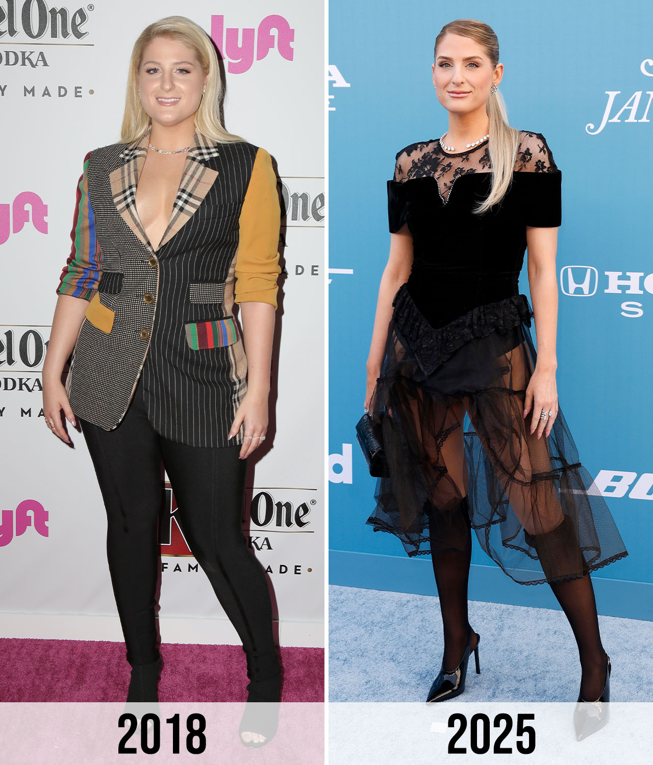 Meghan Trainor Before and After