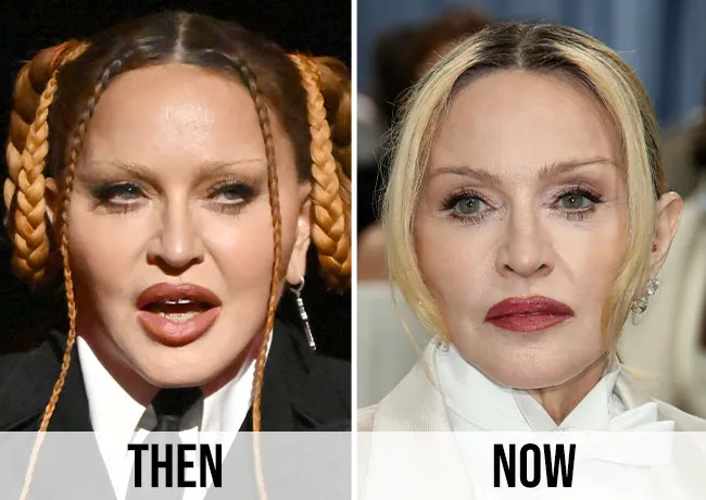 Madonna before and after