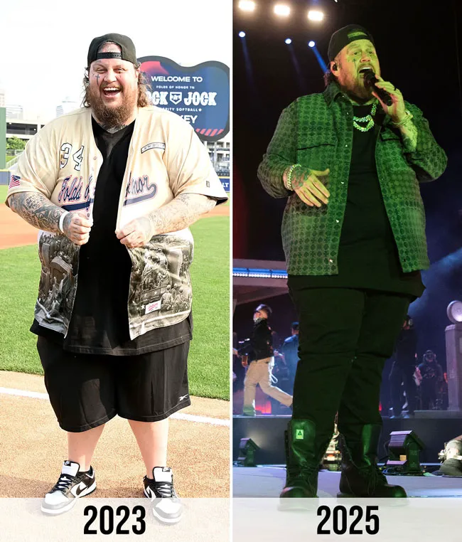 Jelly Roll's weight loss journey from 2023 to 2025.