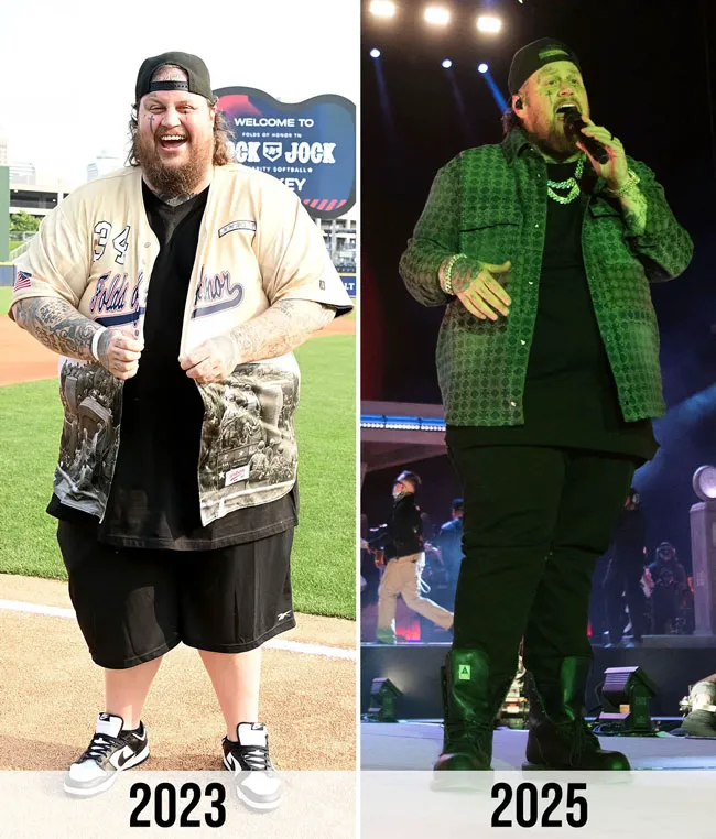 Jelly Roll weight loss before and after