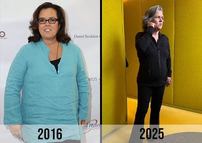 "Before and after photo of Rosie O'Donnell's weight loss transformation"