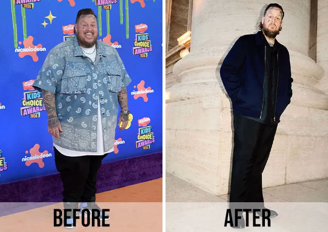 Jelly Roll before and after weight loss