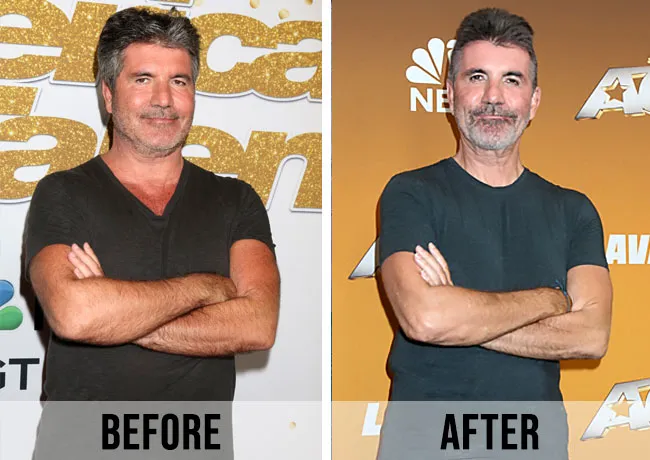 Simon Cowell before and after